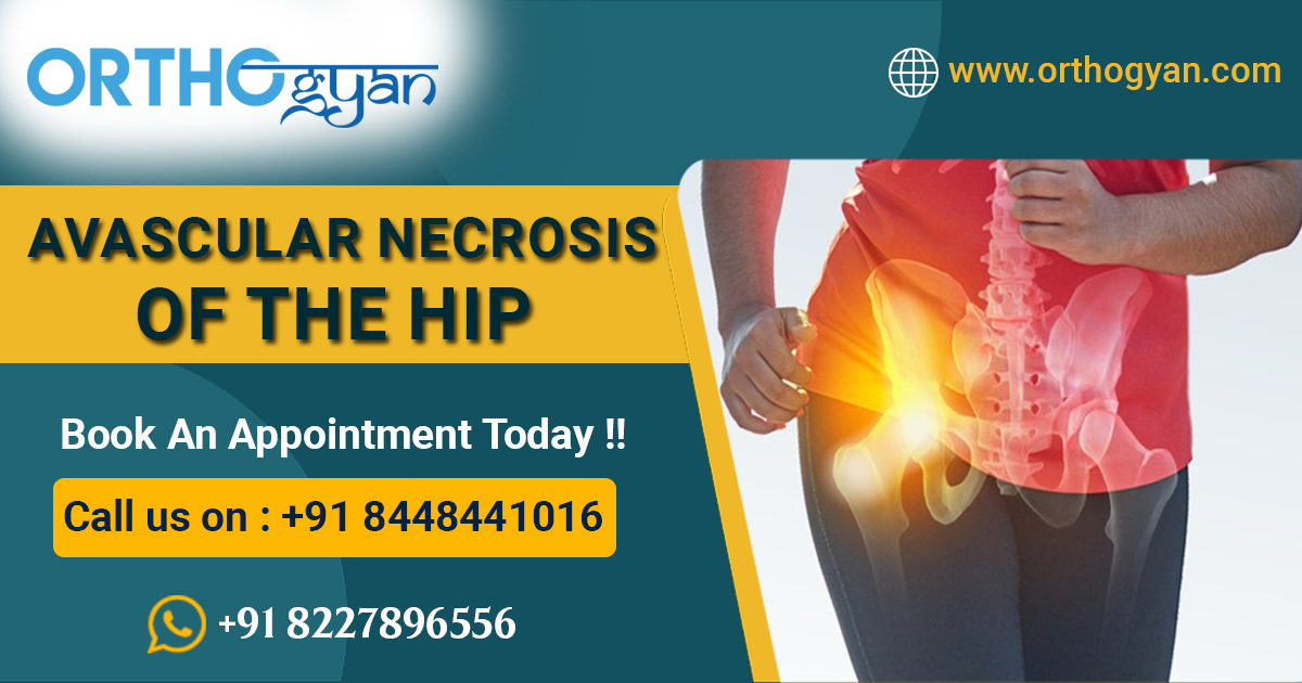 Avascular Necrosis Of the HIP

#patna #bihar #patnadoctor #anupinstitute #orthopaedichospital #drashishsingh #drrnsingh #orthopaedicdoctor #bonedoctor #jointreplacement #jointreplacementsurgery #orthogyan #diagnosis #osteonecrosis #totalhipreplacement #hiposteonecrosis