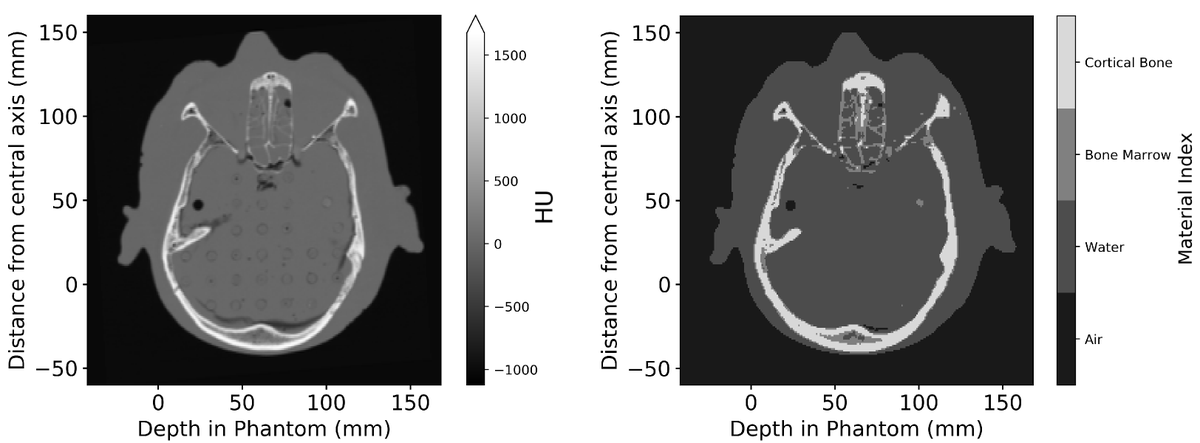 Australian National Imaging Facility (@nifaus) on Twitter photo #NewPaper supported by NIF <a href="/Mon_Bio_Imaging/">Monash Biomedical Imaging</a>: DoseMRT: A Software Package for Individualised Monte Carlo Dose Calculations of Synchrotron-Generated Microbeam Radiation Therapy
doi.org/10.3390/radiat…
<a href="/EletteEngels/">Elette Engels</a> <a href="/SarahPhysicist/">Sarah Vogel</a> <a href="/Tehei_Moeava/">Moeava Tehei</a> <a href="/Stephanie_Corde/">Stéphanie Corde</a> <a href="/susannaguatelli/">susanna guatelli</a> #NewPaper supported by NIF <a href="/Mon_Bio_Imaging/">Monash Biomedical Imaging</a>: DoseMRT: A Software Package for Individualised Monte Carlo Dose Calculations of Synchrotron-Generated Microbeam Radiation Therapy
doi.org/10.3390/radiat…
<a href="/EletteEngels/">Elette Engels</a> <a href="/SarahPhysicist/">Sarah Vogel</a> <a href="/Tehei_Moeava/">Moeava Tehei</a> <a href="/Stephanie_Corde/">Stéphanie Corde</a> <a href="/susannaguatelli/">susanna guatelli</a>