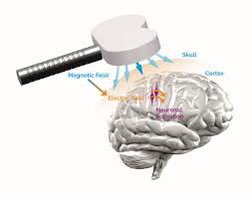 Verändert (noninvasive) Hirnstimulation die Informationsverarbeitung im Gehirn?

ProbandInnen mit und ohne Autismusdiagnose für Studienteilnahme im LVR-Klinikum Düsseldorf gesucht!

Bei Interesse bitte melden bei:
KatjaOurania.Brouzou@lvr.de

Gerne teilen!