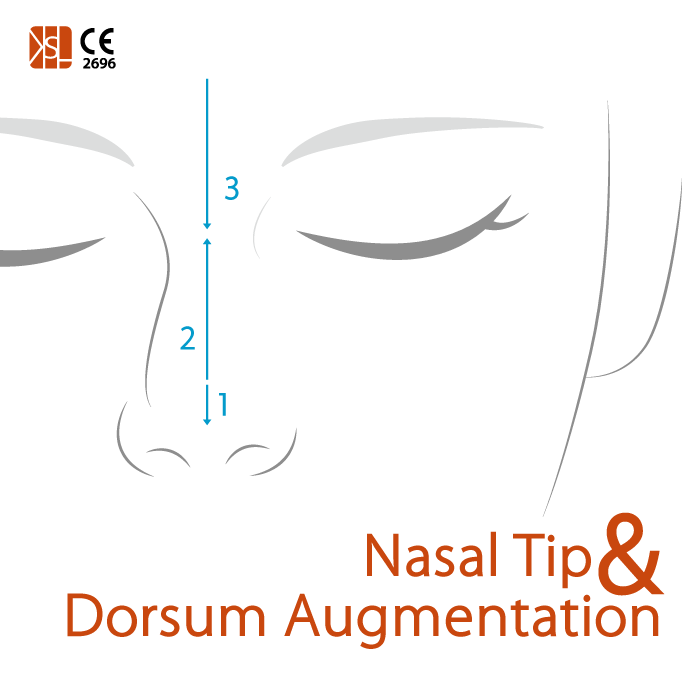 JeongSo44394036's tweet image. Nose-Thread
#ksl #ksllift #liftingthreads #threadslifting #supreme #supremelift #placl #pdo #pdothreads #pcl #pclthreads #moldingthread #monothreads #screwthread #cogthread
#nosethreadlift #duallifting #dualneedlecog #cannula #360degree #coglift #necklifting