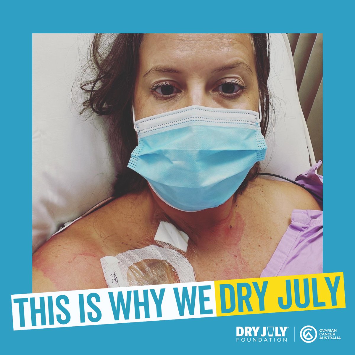 Sign up to have a #DryJuly and ask your friends and family to sponsor you. 100% of the funds you raise will go to ensuring women diagnosed with #ovariancancer can access our critical support services when they need them the most. 

Sign up now ➡️ bit.ly/3XtWXT1