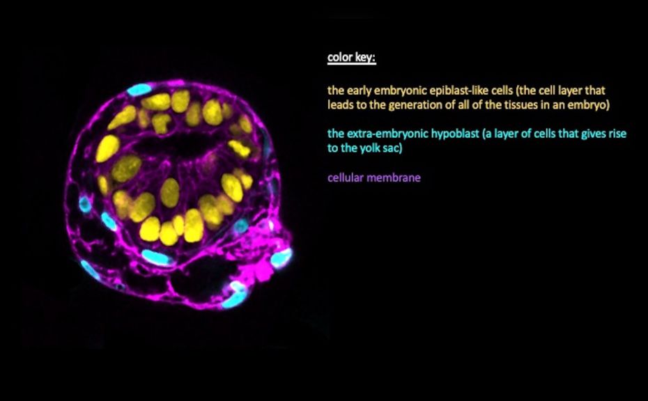 YaleMed's tweet photo. Using #pluripotent #stemcells, a research team including @YaleGenetics’ @BernaSozen_ has created a groundbreaking #organoid #model that mimics human embryos to shed new light on early #development. https://t.co/xVLbKbdckV https://t.co/yt0DzgJ1XF