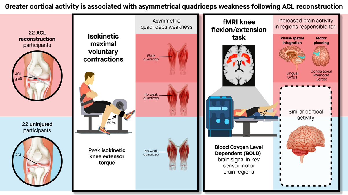 Check it out pubmed.ncbi.nlm.nih.gov/37198275/ Brain activity for knee control after ACL-R is related to asymmetrical quad weakness. ACL-R + asymmetrical quad weakness exhibit greater brain activity compared to other ACL-R participants and controls @criss_cody @JanetSimon51 @Dusty_Grooms