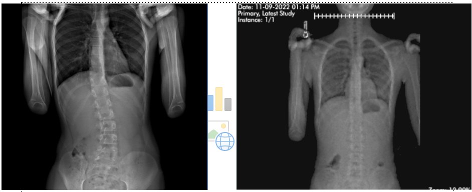 LorenFishmanMD's tweet photo. https://t.co/3RcoWthT4w
https://t.co/OBpEknJkoK https://t.co/CJnmrI0GJ4
