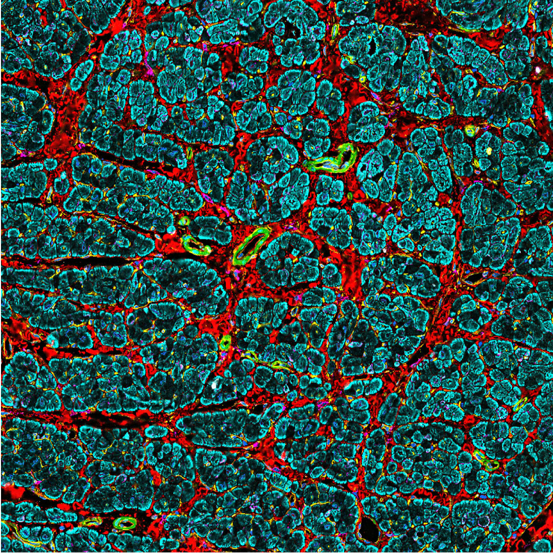 Akoya Biosciences (@akoyabio) on Twitter photo #Spatialbiology at its finest! #PhenoCycler image of the heart's left atrium, the upper heart chamber that receives blood from the lung.
📷 <a href="/cdktmw/">Kai Tan 🇺🇦</a> <a href="/KaiTanLab1/">Kai Tan Lab</a>
This image comes from <a href="/_hubmap/">Human BioMolecular Atlas Program (HuBMAP)</a>'s image of the week gallery. To view more, visit: bit.ly/3mdmb6V #singlecell #Spatialbiology at its finest! #PhenoCycler image of the heart's left atrium, the upper heart chamber that receives blood from the lung.
📷 <a href="/cdktmw/">Kai Tan 🇺🇦</a> <a href="/KaiTanLab1/">Kai Tan Lab</a>
This image comes from <a href="/_hubmap/">Human BioMolecular Atlas Program (HuBMAP)</a>'s image of the week gallery. To view more, visit: bit.ly/3mdmb6V #singlecell