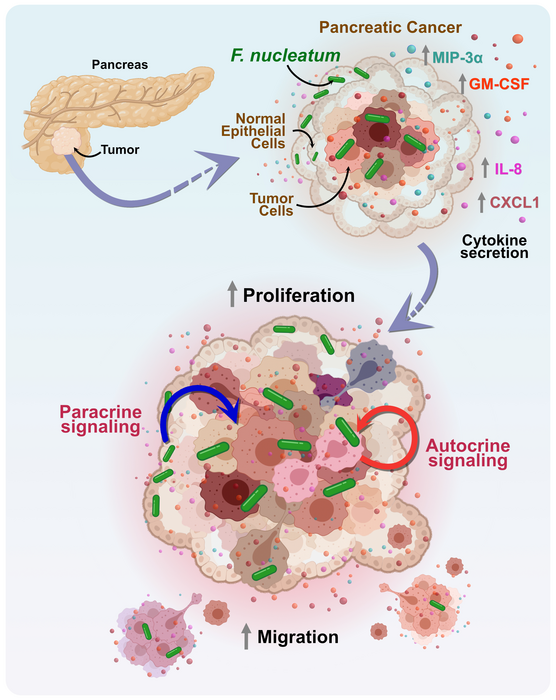 The commensal bacteria #Fusobacterium can promote the migration of #PancreaticCancer cells, according to a 2022 study highlighting the growing importance of the #TumorMicrobiome in cancer progression and therapeutic research. scim.ag/39o #WorldMicrobiomeDay