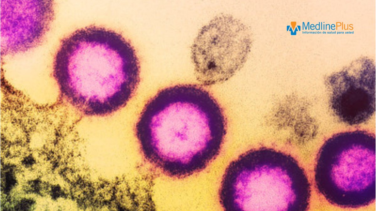 MedlinePlusEsp's tweet photo. La prueba del VIH muestra si una persona se ha infectado con VIH y puede ayudar a detectar el virus temprano para empezar el tratamiento, mantener la salud y evitar propagar el virus. ¿En qué consiste la prueba? Entérate en el enlace https://t.co/shCYfm0FNh #HivTestingDay https://t.co/SBA2JfM3je