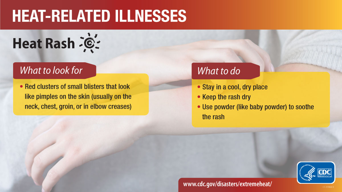 KeepFSUSafe's tweet photo. 🌡️⚕️ With the extreme heat North Florida is experiencing this week, know how to spot signs of heat-related illness and what to do to help yourself and others stay #SeminoleSAFE! https://t.co/fXjCoHWCXy