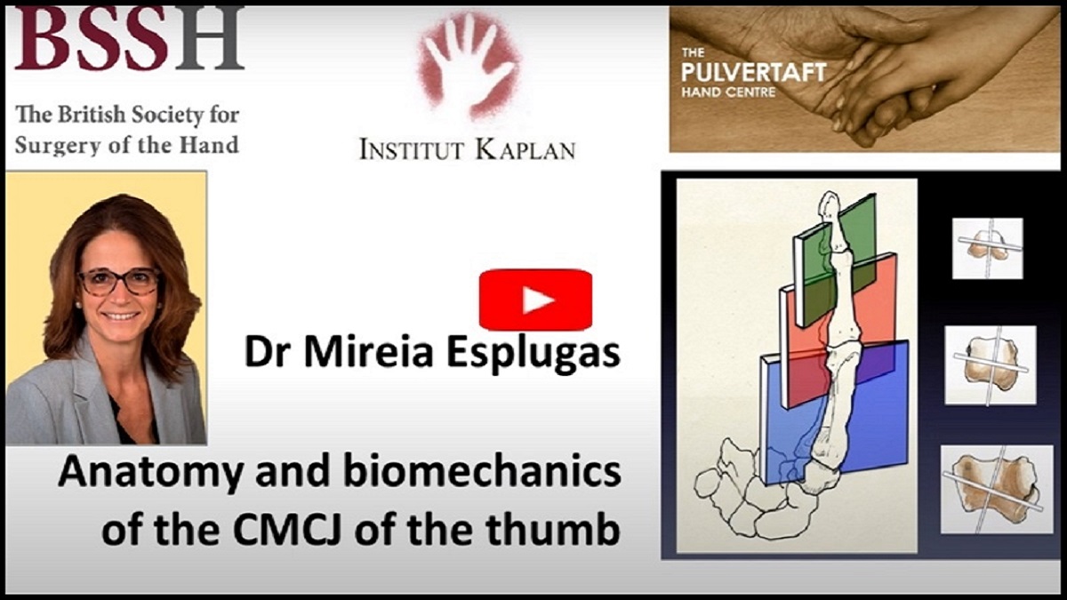 ipokrate's tweet photo. Anatomy and Biomechanics of the CMCJ of the Thumb Mireia Esplugas

Watch from the Pulvertaft Videos series on "The anatomy and biomechanics of the Carpo-metacarpal joint of the thumb, and their clinical implications."

https://t.co/aIPx8RvXZh

#ipokrate #conference #doctor https://t.co/m7PqJWPr8q
