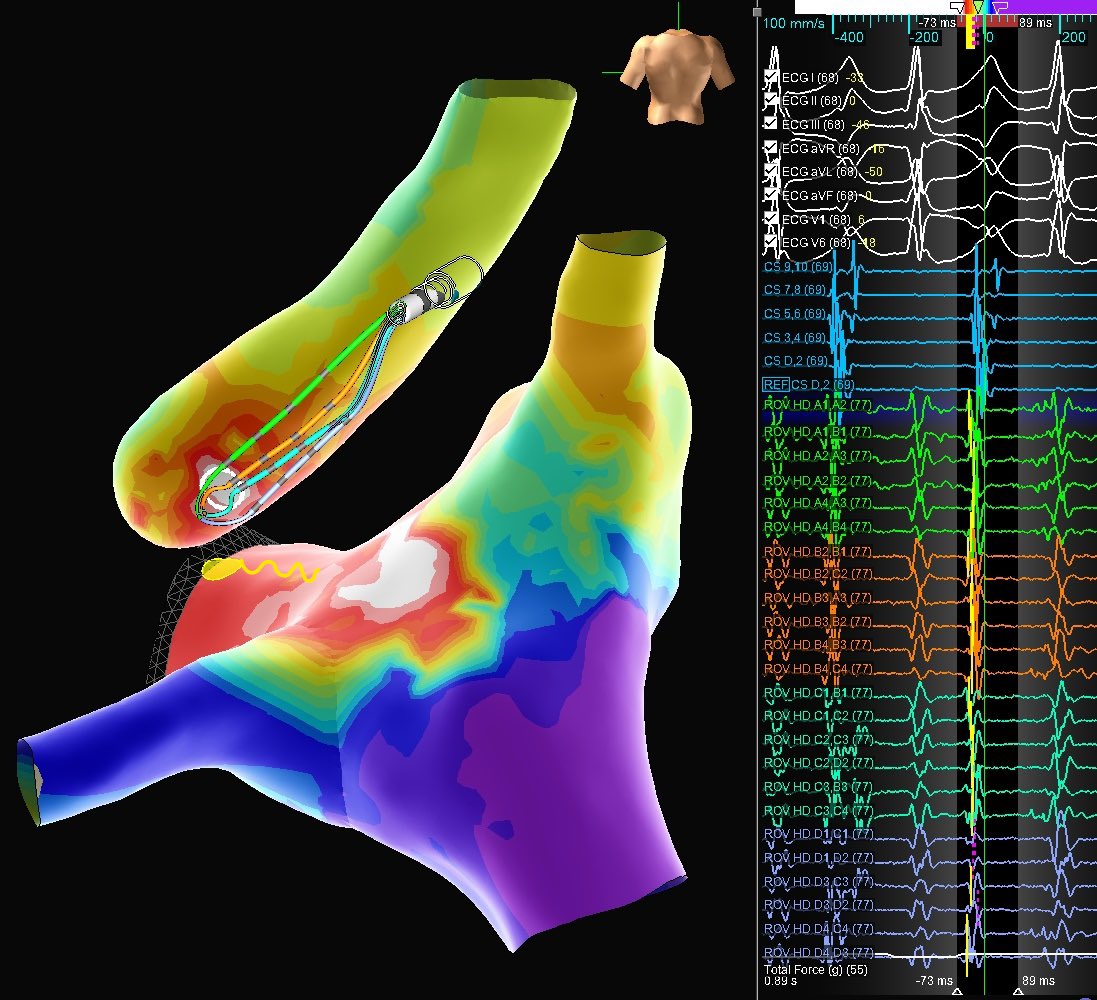 W2 Mappers tweet media