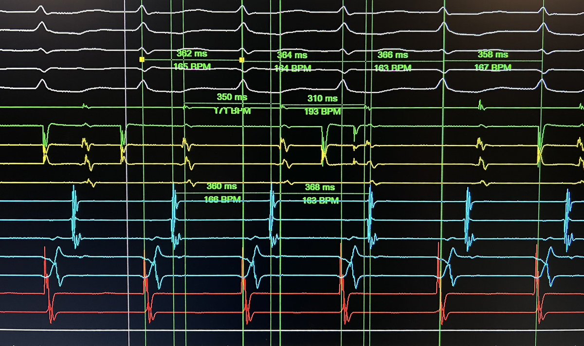 W2 Mappers tweet media