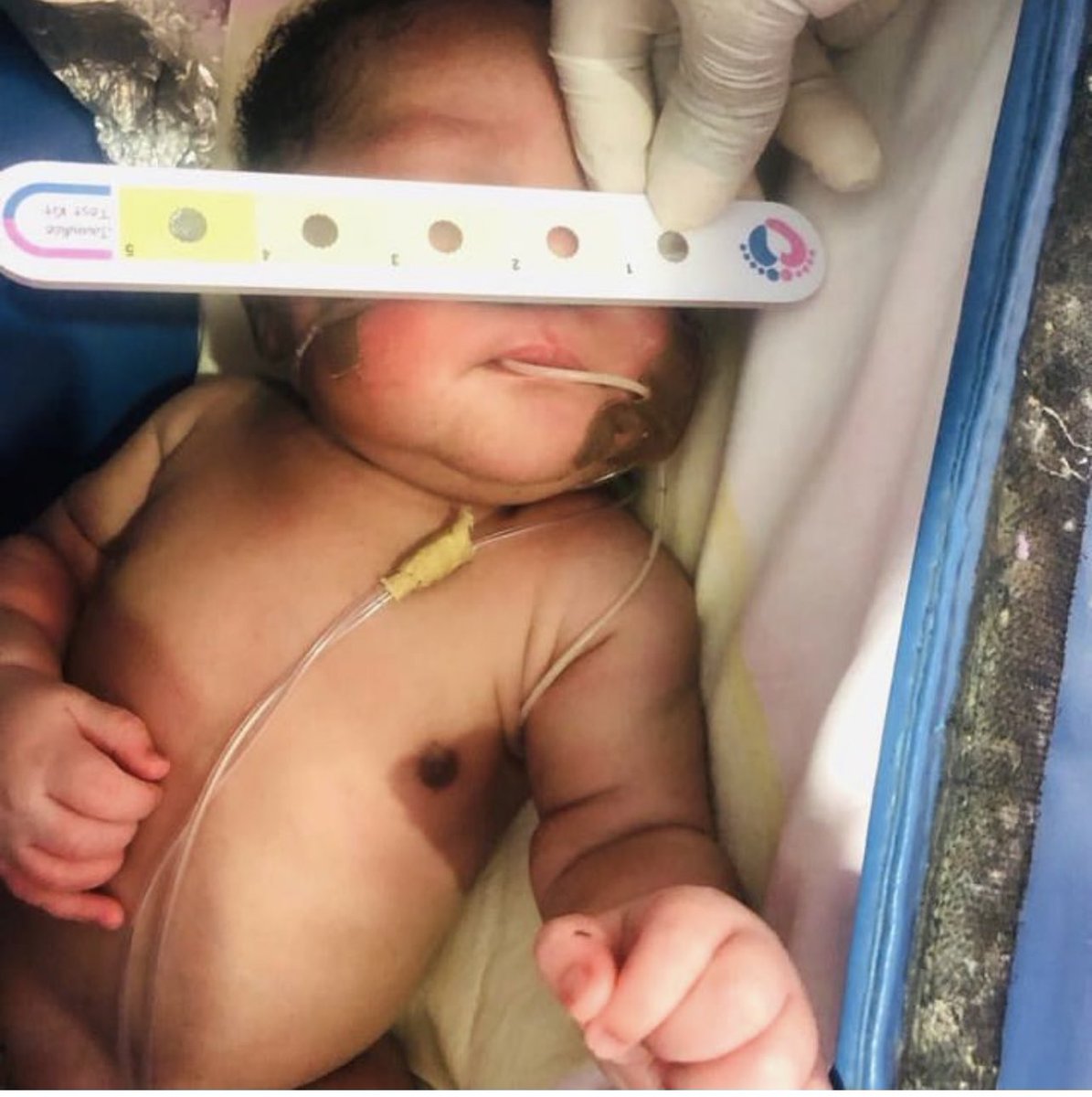 tinyheartshq's tweet photo. “Mama, come see your pikin”. 
And she sent us this picture to show me how far they’ve come together. 

1. The ruler you see on the baby, we produce and deploy it to mothers for sale. https://t.co/XMVoXZ6fSY