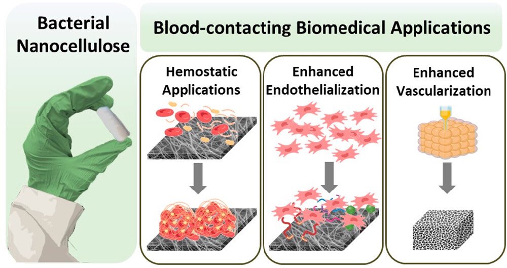 MaryamBadv's tweet photo. Our latest paper on the utilization of bacterial nanocellulose-based #biointerfaces for blood-contacting #medical applications is now online!

https://t.co/j5d6OJ9ohz https://t.co/f56HNNfRtJ