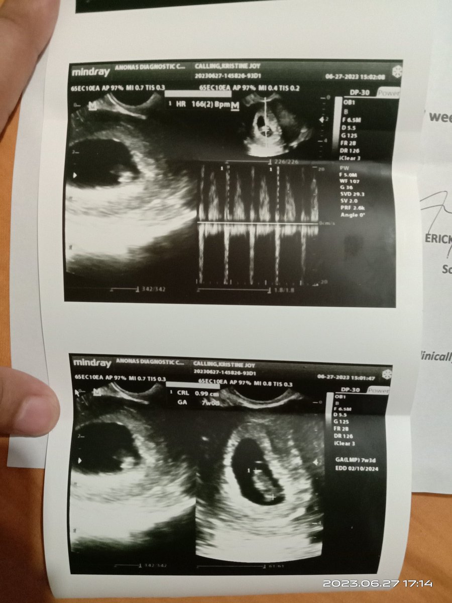 Kristine98WP's tweet photo. First came love, then came you. 👶❣️ https://t.co/xK4UFlt4nE