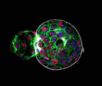 PavlaHub's tweet photo. The @Chaperon_LFP invites you to participate in their #NerdArtPrize2023 contest! 📸🖼️
Submissions of your best photo or picture are accepted until Sep 15, 2023, in two separate categories: 
• Science &amp; Research
• Freestyle – i.e. any topic
https://t.co/uPsHgUd2j0 https://t.co/CkOTHP25vQ