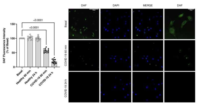 AJP-Heart and Circ (@ajpheartcirc) on Twitter photo #ArticlesInPress: Cytokine storm in individuals with severe COVID-19 decreases #endothelial cell antioxidant defense via Downregulation of the Nrf2 transcriptional factor
(Rodrigues et al.)
ow.ly/LolT50OZj9J
<a href="/Tosteslab/">The Tostes Lab</a> <a href="/orodriguesdani/">Daniel Rodrigues</a> <a href="/usponline/">USP - Universidade de São Paulo</a>
#Nrf2 #CytokineStorm #ArticlesInPress: Cytokine storm in individuals with severe COVID-19 decreases #endothelial cell antioxidant defense via Downregulation of the Nrf2 transcriptional factor
(Rodrigues et al.)
ow.ly/LolT50OZj9J
<a href="/Tosteslab/">The Tostes Lab</a> <a href="/orodriguesdani/">Daniel Rodrigues</a> <a href="/usponline/">USP - Universidade de São Paulo</a>
#Nrf2 #CytokineStorm