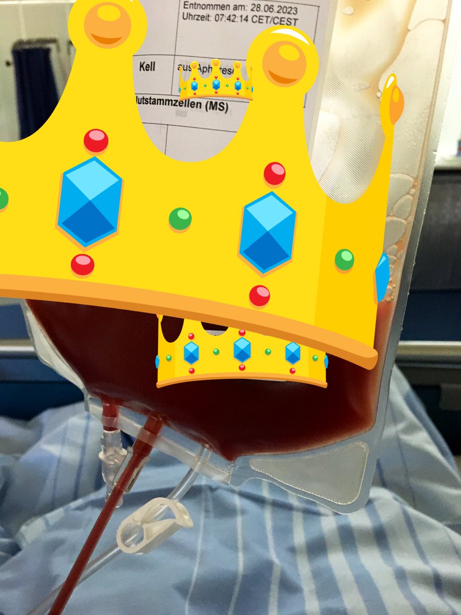 prickelndfr1sch's tweet photo. Habe soeben Stammzellen gespendet und hoffe sehr, dass sie gut helfen!! 🍀Und es war zwar in der Stimulation anstrengend, aber in der Abnahme total machbar ♥️ #stammzellspende Bitte registrieren!! https://t.co/jlenLfv51c
