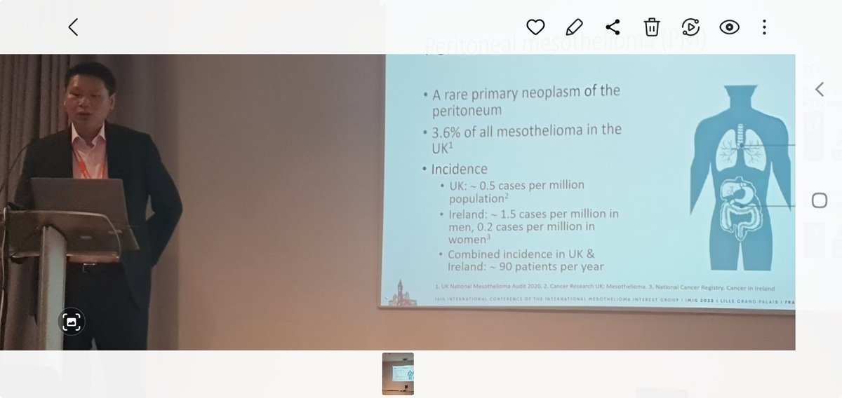 Sam Westbrook (@sam_meso) on Twitter photo Tuesday
<a href="/imig2023/">iMig2023</a>
Dedicated peritoneal meso session. P.Sugarbaker discussing adj bidirectional IV Cis, IP pem. <a href="/TomCecilMD/">Tom Cecil</a> and Victor presenting <a href="/BasingstokePmi/">PMI Basingstoke</a> experience, <a href="/oliviawriting/">Olivia Sgarbura</a> MESO-TIP PIPAC data. France 10yr experience. Tuesday
<a href="/imig2023/">iMig2023</a>
Dedicated peritoneal meso session. P.Sugarbaker discussing adj bidirectional IV Cis, IP pem. <a href="/TomCecilMD/">Tom Cecil</a> and Victor presenting <a href="/BasingstokePmi/">PMI Basingstoke</a> experience, <a href="/oliviawriting/">Olivia Sgarbura</a> MESO-TIP PIPAC data. France 10yr experience.