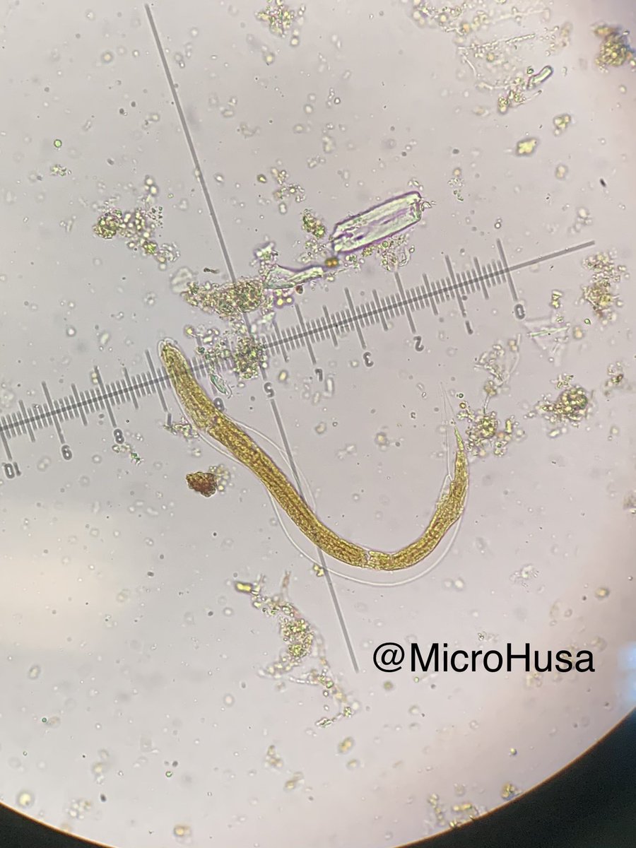 Cultivo positivo para Strongyloides stercoralis. 

Foto 1: rastros que deja el nematodo al desplazarse por el Agar 🧫.

Foto 2: larva rabditiforme vista al 20x 🔬.

#microbiology #IDTwitter #parasitology