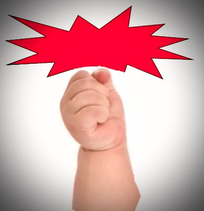 OBMedicine's tweet image. We now have an Impact Factor!

For 2022 (based on articles published 2020 &amp;amp; 2021)   =  👉 0.7 👈

Onwards &amp;amp; upwards from here!