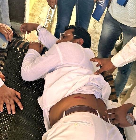 Bhim Army Cheif Chandrashekhar Azad Shot at in Uttar Pradesh.
UP is the Epitome of Safety Violations and Jungle Raj.