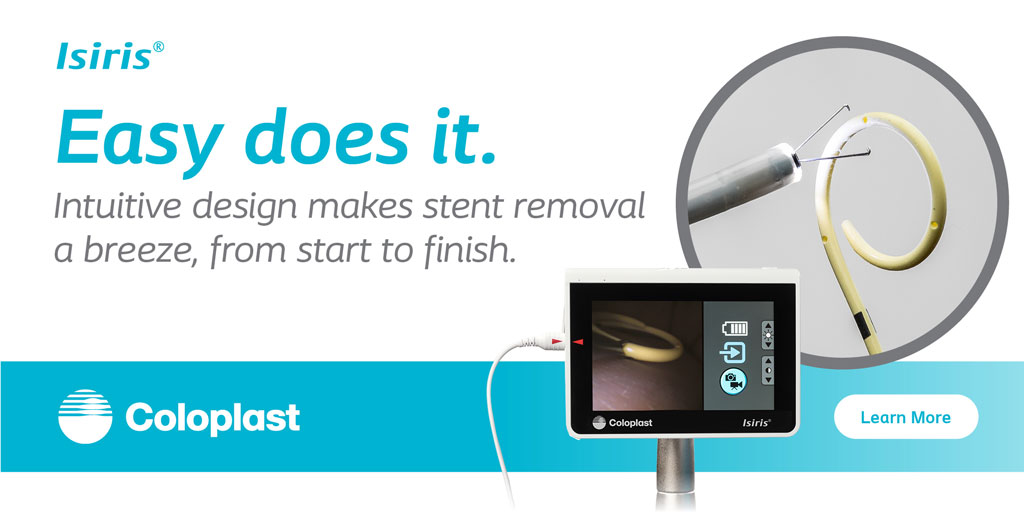 Coloplast_MD's tweet photo. It’s easy with #Isiris. No cleaning, re-processing, or repair needed to efficiently remove double loop #stents from sizes 4.8 to 9 FR. To learn more and to view important safety information, please visit: https://t.co/Dreia3hvE3 #Coloplast #UroSoMe #Endourology https://t.co/liLS1HTOAv