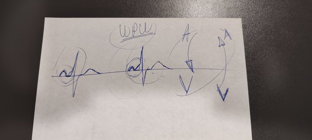 I make drawings to explain what type of arrhythmia my patient has.  who else does the same? 
<a href="/LeandroTomasEP/">Leandro Tomas</a> <a href="/nerd_ep/">EP nerd 2000</a> <a href="/ArritmiasSAC/">Consejo de Arritmias SAC</a> <a href="/LAHRSonline1/">LAHRS</a>