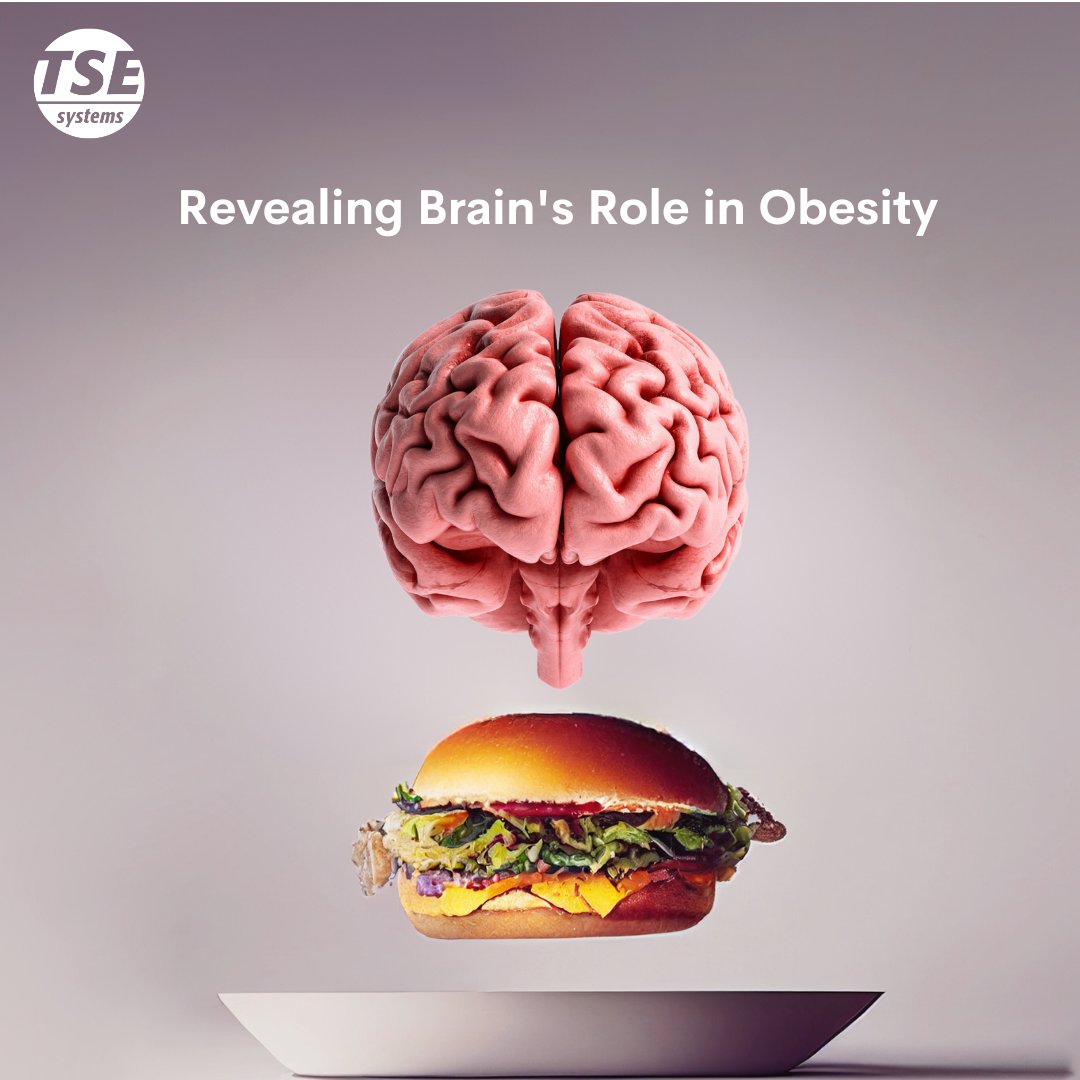 TSESystems's tweet photo. New research published in Nature Metabolism reveals intriguing insights into the connection between obesity and the brain reward system. Read more: https://t.co/FPgq2OQE8t #neuroscience #obesity #metabolism #PhenoMaster #TSESystems https://t.co/pfovGvEoIJ