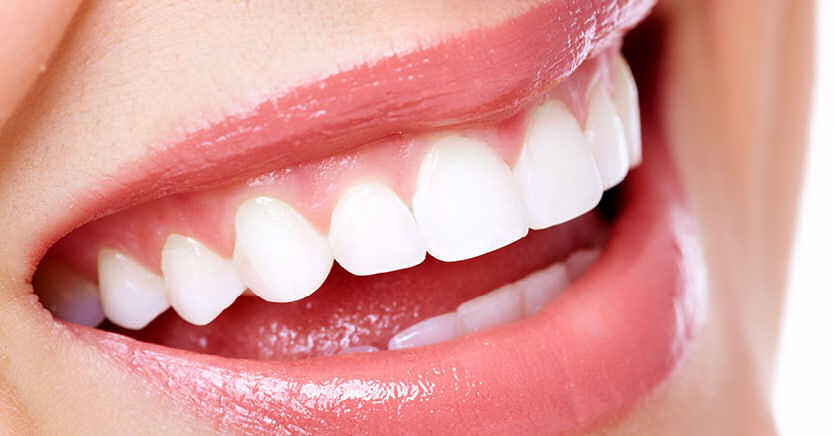 CarbamideTeeth's tweet photo. Order our teeth whitener today and we will ship it for FREE!  #whiteteeth https://t.co/Mw4IqtXCUd