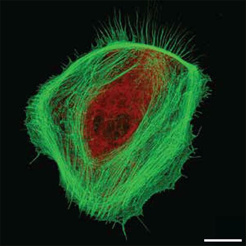 AdvPortfolio's tweet photo. This image shows an actin structure within primary astrocytes, providing valuable insight into the active role of astrocytes in neural networks.

@VBenfenati @WLosert @drkatemon @emanuelasaraci4 @AFOSR @Astrotechproje1 

View more in "Science in pictures": https://t.co/0r4rN4LH2h https://t.co/DF5EZyL4ml