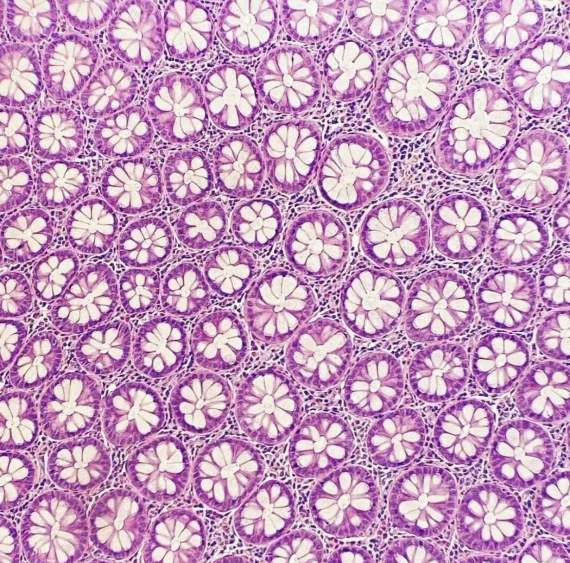 OGdukeneurosurg's tweet image. Very pretty… any idea what it is? Source: med points