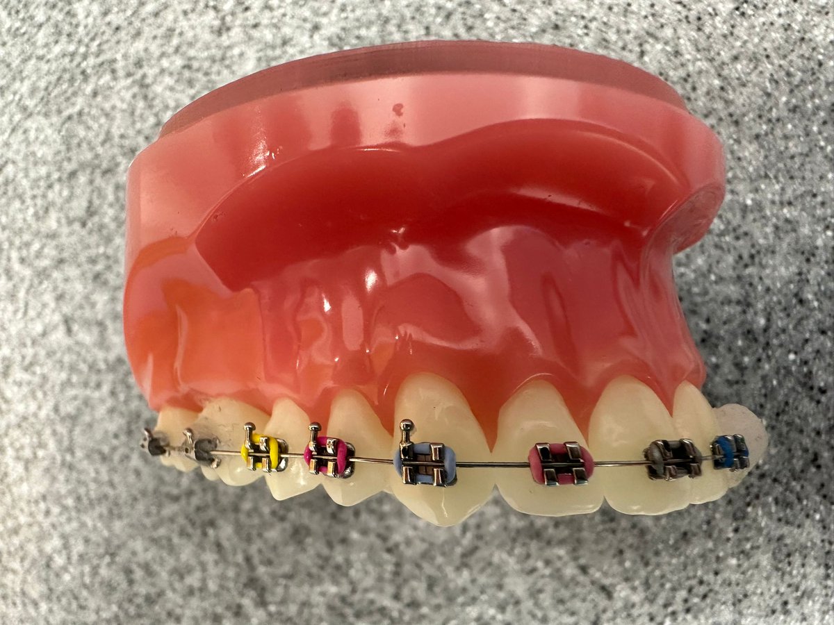 Which band colour will you choose next?

Colours aren't just for children - many of our adult patients go for a coloured band too, to make their brace journey more fun! 🌈

#braces #brace #orthodontist #specialistorthodontist #bedford #bedfordshire #colouredbracesbands
