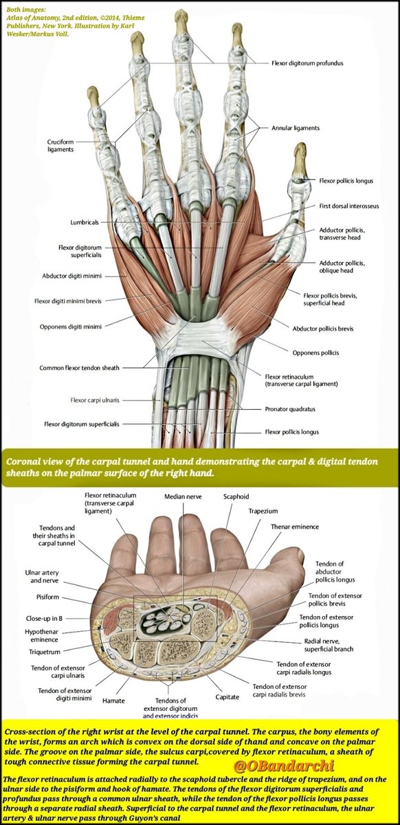 Coronal &amp; Cross­-section of wrist at level of carpal tunnel shown👍
✴️Transverse carpal ligament (TCL) is the "roof" of the carpal tunnel,but the "floor" of ulnar tunnel (Guyon’s canal ).

✴️Median nerve mostly exposed to compression-related damage in area of the carpal tunnel.