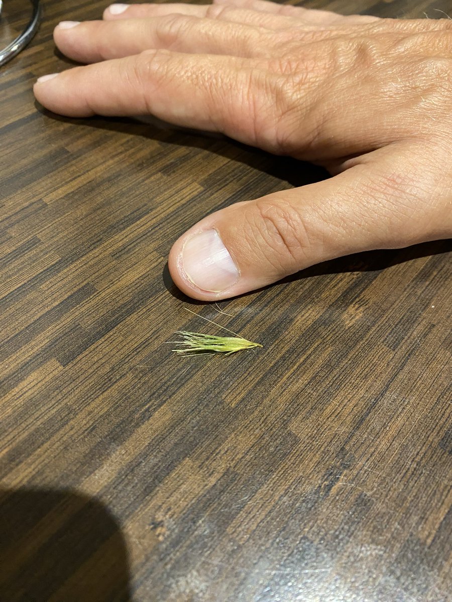 Ok so I might have been chewing/licking my paw a bit today (humum says a lot😱😱) 
she finally got hudad to hold me so she Hibiscrub my paw just to be safe she looked between my pads 
Look what she found wedged up there😱😱😱 

so pls check paws if me pals chewing 😘😘 #btposse