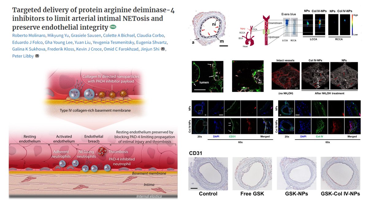 HaoYin20's tweet photo. Collagen IV-nanoparticle delivers PAD4i GSK484 to eroded atherosclerotic lesions with exposed basement membrane
⏫lesional #EndothelialCell coverage
⏬local NET
in🐭flow-mediated #SuperficialErosion
Dr. Jinjun Shi & Peter Libby labs #CardiovascRes 2021
https://t.co/p7lFBgFH4A https://t.co/uCN3hhsapL