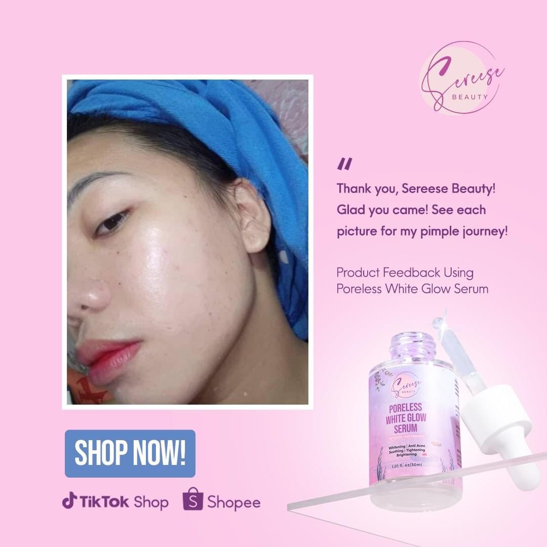 cutietamiya88's tweet photo. Sereese Beauty Product Review! https://t.co/8v1ihyNAnQ