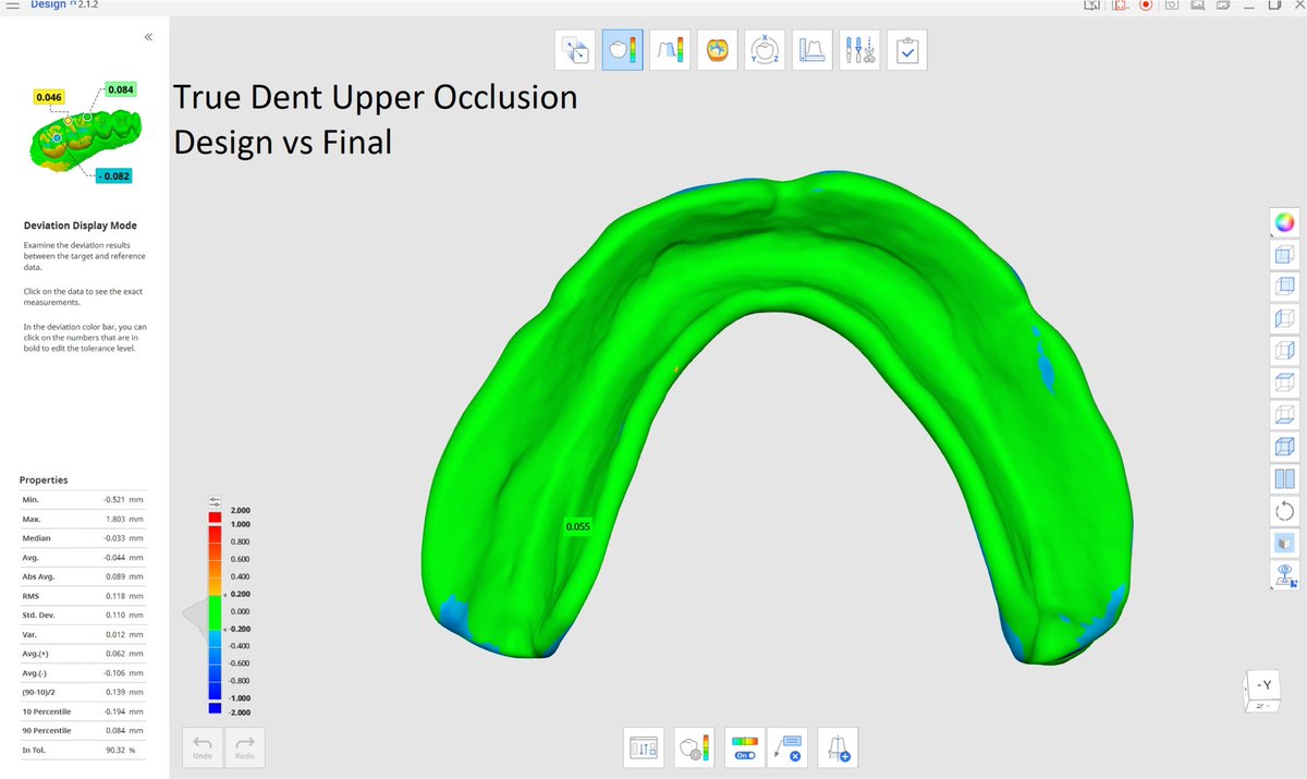 xdentallab's tweet photo. In 2023 we were absolutely astonished by the True Dent Digital Denture Solution.  The anatomy of our digital designs were maintained, the internal morphology and translucency of the teeth were very realistic, the precision and exactness of the fits with out having to make manual adjustments were something we had yet to experience.  The color of the gingiva and the vein and fiber effects all just simply made our jaws drop.   We truly had produced a polychromatic, monolithic denture! Not only can we now 3D print a truly aesthetic and life-like denture, but we can now produce up to 40 dentures all with various denture tooth shades and denture base shades in one print job.  The True Dent Dentures simply look exactly like our digital designs, fit amazingly, and require no special handling nor extra hand work.  We can also print indications that were previously difficult or near impossible to produce like partial acrylic dentures, and Implant bridge prototypes while also allowing us to maintain our original contours without having to over contour our prosthetics with pink veneering materials.  We are now able to achieve desired results with ease. This predictability and reliability of True Dent has allowed us to really take on digital dentures with 100% confidence in our product. Whatever we design on any given day will be printed and ready for delivery the following day with minimum post processing effort.

One of our biggest complaints with doing a two piece denture is that there is a change in the fit due to the printing process and a change in vertical introduced in the manual bonding process of the teeth.  Also the design is modified in two piece dentures to create sockets for the denture and connectors are added between the denture teeth.  These modifications always result in a distortion of the original digital design and a change in fit from try in to final. 

To illustrate the change in fit and aesthetics with LDP from our original designs, I created two dentures using one single denture case design; one set was manufactured using the LDP workflow and the other using the True Dent workflow.  I then took photos to illustrate the change in aesthetics from my original design and to compare the difference between the two.  I then scanned in the produced dentures to compare them to the original digital design.  To ensure that this was done blindly I gave my staff the instructions to design an upper and lower complete denture on a single model I provided and told them to print one denture set using LDP and the other using True Dent.  The results are telling and reaffirm the complaint and concerns of our dentists and technicians with two piece dentures.  

True Dent is a great solution because it is replicable, dependable, scalable, and aesthetic. 

If you have not seen one yet, let me know and I will get on in your hands!  

#digitaldentistry #digitaldentures #ldp #truedent #stratasys #dentajet #polyjet #dentures