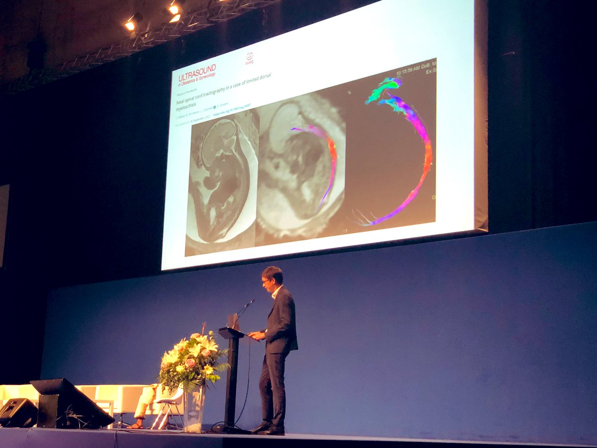 An amazing lecture about fetal diffusion tensor imaging given by Romain Corroenne at #FMF23

Can not wait to see what the future holds on this field!