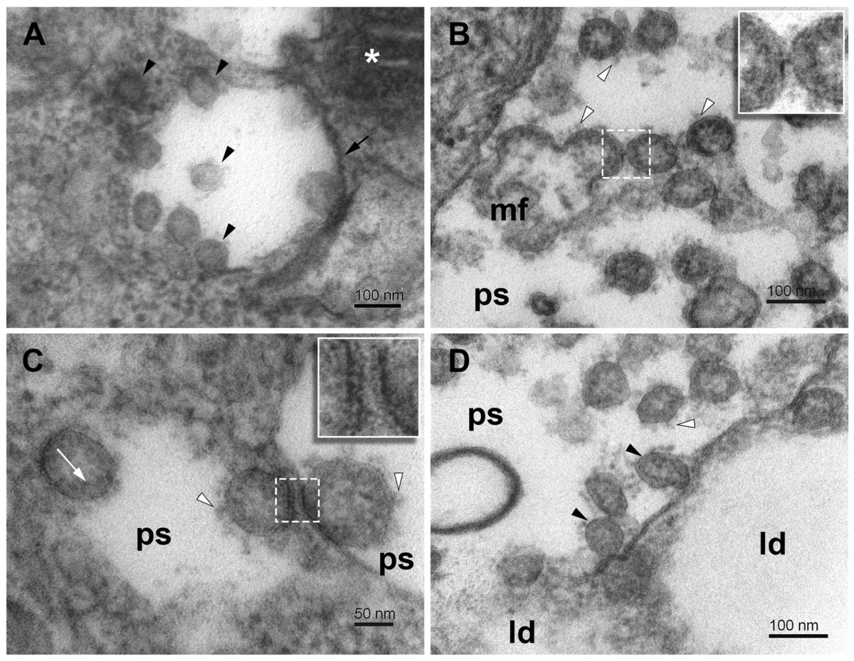 Pathogens_MDPI's tweet photo. 📢 #SARSCoV2 Exploits Non-Canonical #Autophagic Processes to Replicate, Mature, and Egress the Infected Vero E6 Cells
👨‍🎓 by Juraj Koči et al.
🔗 https://t.co/nfXnq1kLr4
👉 Special Issue: SARS-CoV-2: From Virus Replication Cycle to Antiviral Strategies
https://t.co/GKNcwEaQfv https://t.co/OHHpXV5Lbv