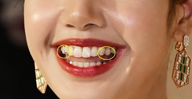 블랙핑크 리사 치아에 하트가 ‘반짝’...‘투스젬’ 뭐길래 (출처 : 매일경제 | 네이버 뉴스) 

naver.me/53BzJ8HD 

LALISA BULGARI SERPENTI 
#LISAXBVLGARI #Bulgari #불가리 #ブルガリ 
#リサ・マノバン #ブラックピンク  #LISA  #BLACKPINK <a href="/Bulgariofficial/">Bvlgari</a>