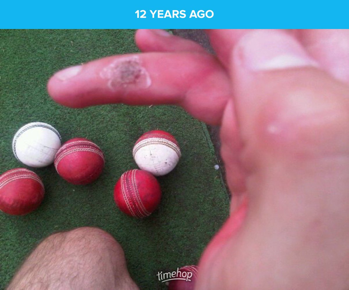 Well I knew what Moeen went through. This crater never healed to allow me to bowl huge reps. Super glue, fryars… nothing working. Still a crater in my spinning finger.