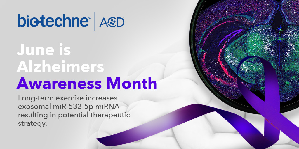 bt_spatial's tweet photo. June is Alzheimer’s Awareness Month. Liang et al. utilize #miRNAscope ISH to spatially localize exosomal miR-532-5p miRNA and demonstrate improved blood-brain barrier function.
Read more: https://t.co/efKtMBvsc6
#AdvancingYourRNAISH #AlzheimersResearch https://t.co/9CFfC9uTtz