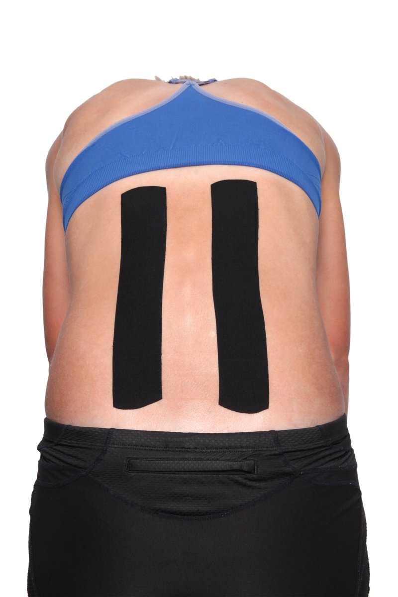 Kinesio_UK's tweet photo. #Kinesio Pre-cut Back Application is designed to support over stretched back muscles and lower back pain. The tape can be worn for 2-3 days, 24 hours a day. It is hypoallergenic, made from 100% cotton and latex free. https://t.co/jaPIZ7uMRl