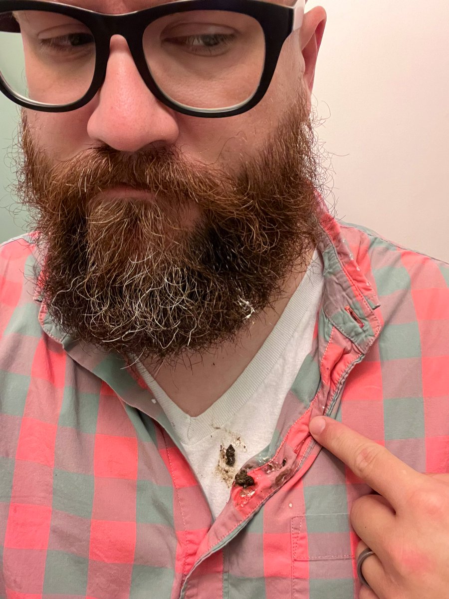 Walked outside to put bags in the car in preparation for the morning commute.

It immediately started raining and then a bird shat upon my face down the front of my chest.

Silly gifs appreciated to even out the vibes.