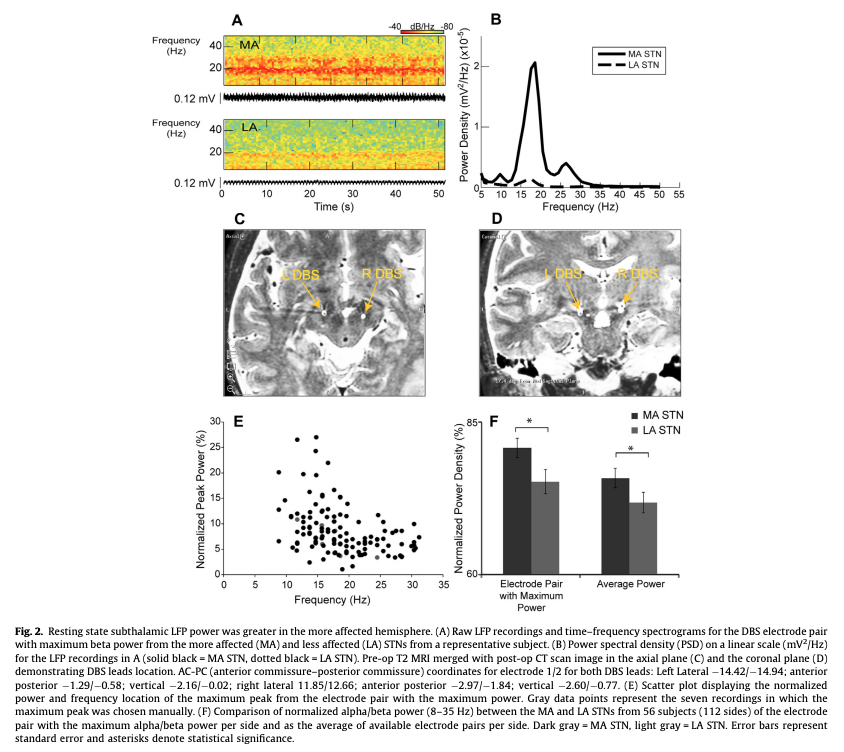 IFCN and its Clinical Neurophysiology journals tweet media