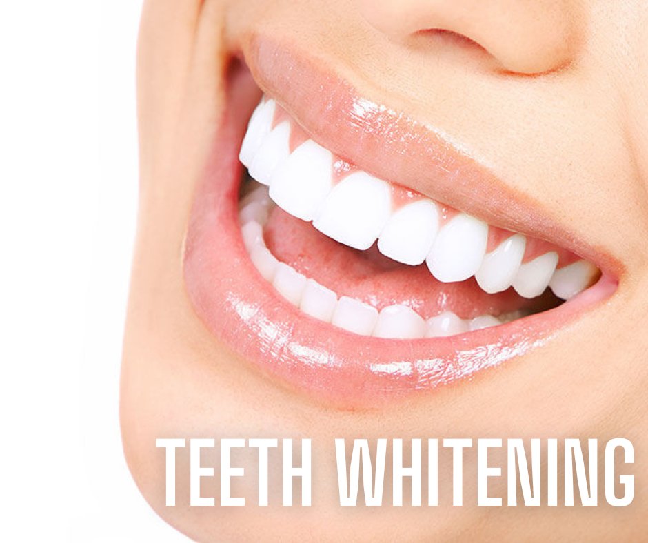 CarbamideTeeth's tweet photo. Order your teeth whitening kit today and get FREE shipping!  #teethwhitening https://t.co/ZwTD0XpxIs