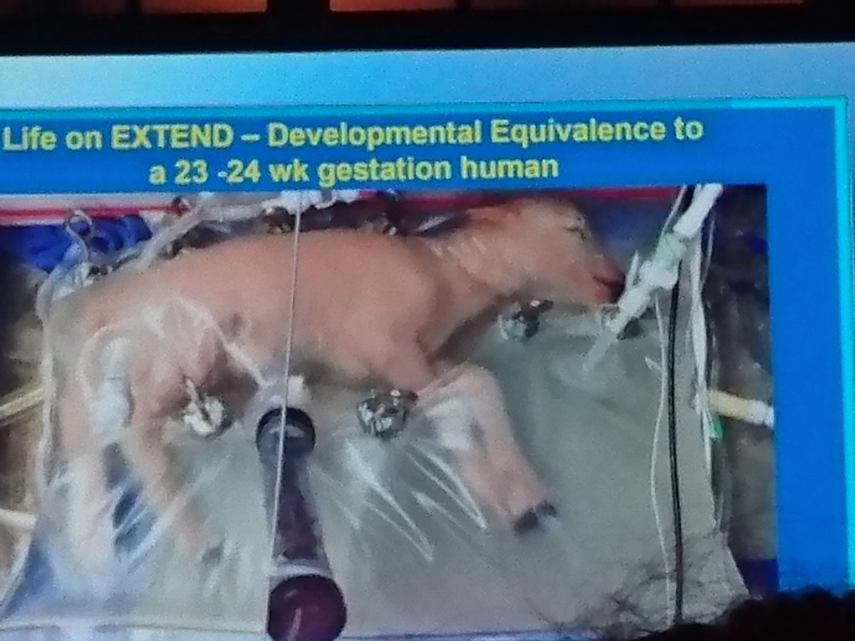 auntsis99's tweet photo. World Congress in Fetal Medicine Day 1 Blockbuster 😲😃Drs Flake and Eixarch report progress in developing an artificial placenta https://t.co/7fZBi18Sko
