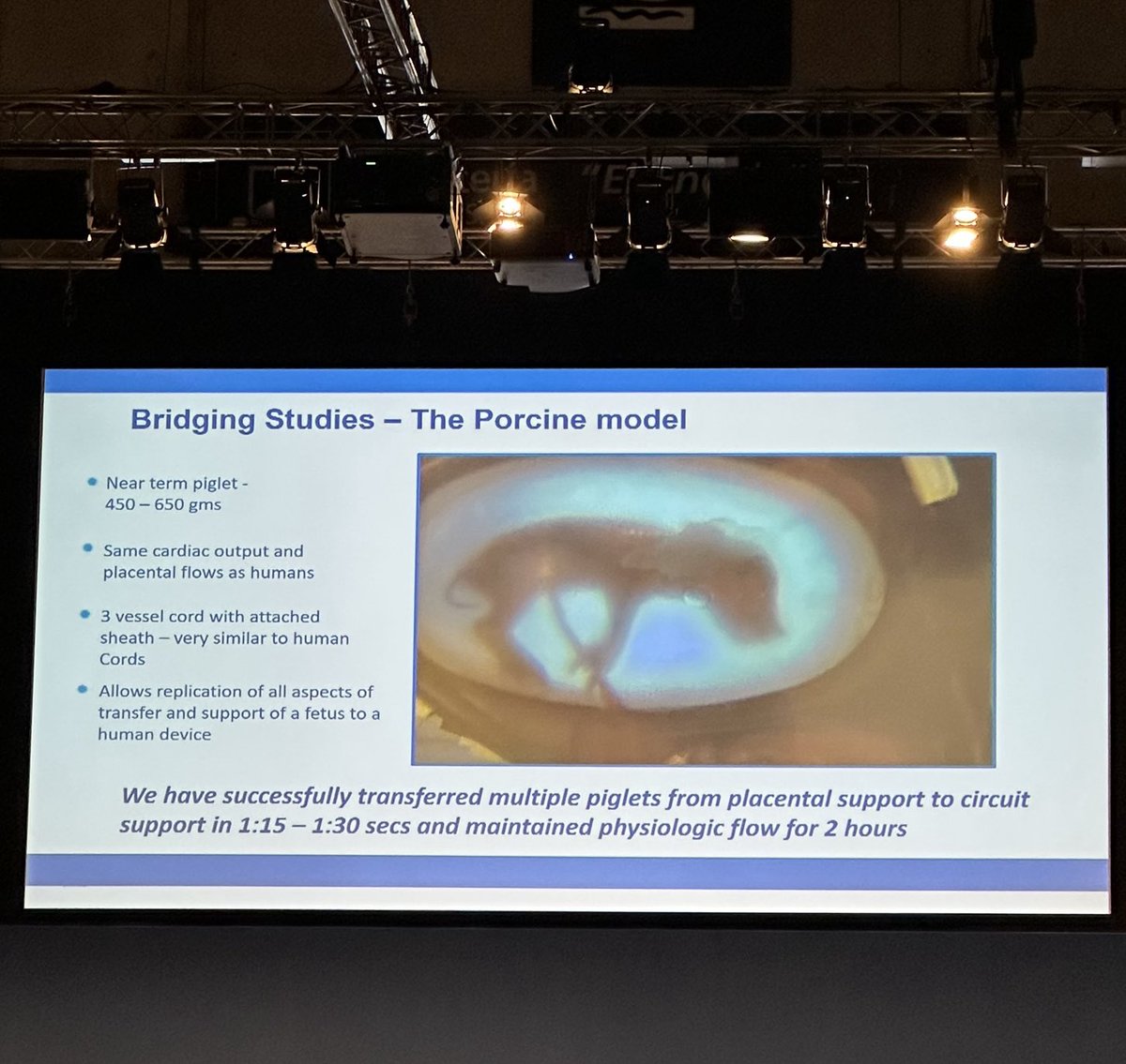 World Congress in Fetal Medicine Day 1 Blockbuster 😲😃Drs Flake and Eixarch report progress in developing an artificial placenta