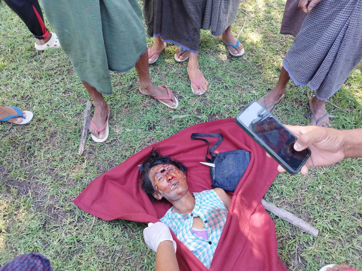 YeSoe91920267's tweet photo. Junta's military had raided #Samoon village, then a civilian was killed by their shot into the car of #IDPs and also   many people were abducted.#Jun29
Read more->https://t.co/tbw9BGqjoU
#WarCrimesOfJunta 
#2023Jun30Coup 
#WhatsHappeningInMyanmar https://t.co/fTKx4e9Ks8