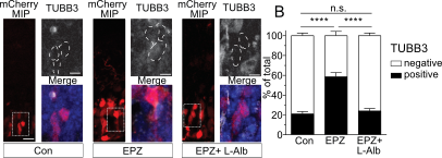 CamilaFullio's tweet photo. We confirm the functional involvement of Asns, as the increased neuronal differentiation upon EPZ treatment was completely abolished by co-inhibition of the ASNS activity https://t.co/qvoqzMzw7r